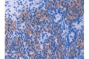 Detection of UMODL1 in Mouse Ovary Tissue using Polyclonal Antibody to Uromodulin Like Protein 1 (UMODL1) (UMODL1 抗体  (AA 34-306))