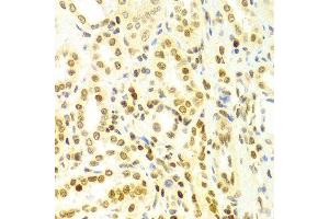 Immunohistochemistry of paraffin-embedded Human kidney using DKC1 antibody at dilution of 1:100 (x400 lens). (DKC1 抗体  (AA 245-514))