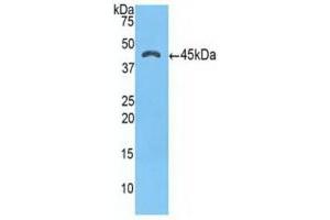 Western blot analysis of recombinant Human a1ACT. (SERPINA3 抗体  (AA 235-394))