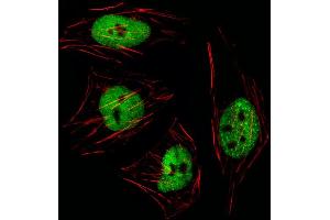 Fluorescent image of Hela cell stained with GTF2I Antibody (N-term) (ABIN1539271 and ABIN2849619)/SA111012BI. (GTF2I 抗体  (N-Term))