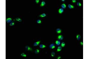 Immunofluorescence staining of Hela cells with ABIN7167196 at 1:400, counter-stained with DAPI. (RAC1 抗体  (AA 11-185))