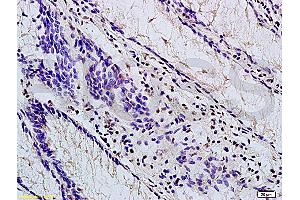 Formalin-fixed and paraffin embedded mouse stomach labeled with Anti-TBL1X Polyclonal Antibody, Unconjugated (ABIN705416) at 1:200 followed by conjugation to the secondary antibody and DAB staining (TBL1Y 抗体  (AA 501-577))