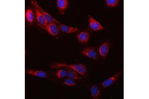 IF analysis of SUCLG1 using anti-SUCLG1 antibody (ABIN7600906). (SUCLG1 抗体  (AA 25-346))