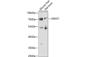 Western blot analysis of extracts of various cell lines, using SPINT1 antibody (ABIN6131743, ABIN6148359, ABIN6148360 and ABIN6222046) at 1:1000 dilution. (SPINT1 抗体  (AA 234-513))
