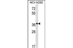 Western Blotting (WB) image for anti-Pepsinogen 5, Group I (Pepsinogen A) (PGA5) (AA 354-383), (C-Term) antibody (ABIN1537193)