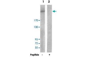 Western blot analysis of extracts from HepG2 cells, using PIKFYVE polyclonal antibody . (PIKFYVE 抗体)
