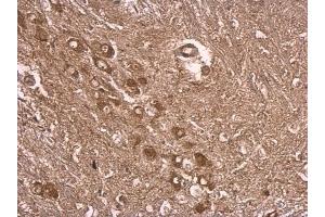 IHC-P Image UBE3A antibody detects UBE3A protein at cytosol on mouse middle brain by immunohistochemical analysis. (ube3a 抗体)