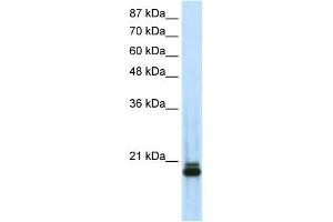 WB Suggested Anti-SAAntibody Titration:  0. (SAP18 抗体  (N-Term))