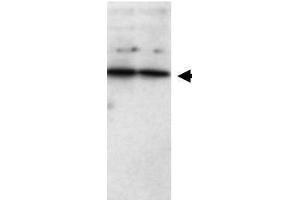 Western blot using  Affinity Purified anti-SFRP1 antibody shows detection of a band ~37 kDa (arrowhead) corresponding to SFRP1 in lysates from human cultured airway epithelial cells. (SFRP1 抗体)
