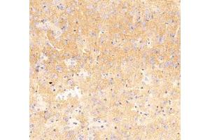 Immunohistochemistry analysis of paraffin embedded mouse Hippocampus using Nrg4 (ABIN7074805) at dilution of 1: 300 (Neuregulin 4 抗体)