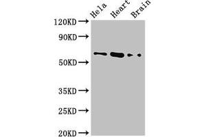 Western Blot Positive WB detected in: Hela whole cell lysate, Mouse heart tissue, Mouse brain tissue All lanes: BAIAP2 antibody at 3. (BAIAP2 抗体  (AA 123-368))