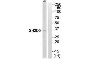 Western blot analysis of extracts from 293 cells, using SH2D5 antibody. (SH2D5 抗体  (C-Term))