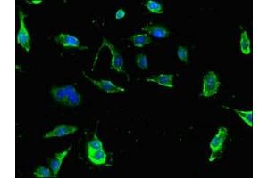 Immunofluorescent analysis of U251 cells using ABIN7173610 at dilution of 1:100 and Alexa Fluor 488-congugated AffiniPure Goat Anti-Rabbit IgG(H+L) (Tryptophan Hydroxylase 1 抗体  (AA 257-405))