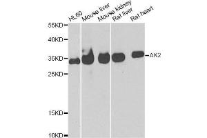 Western blot analysis of extracts of various cell lines, using AK2 antibody. (Adenylate Kinase 2 抗体  (AA 1-232))