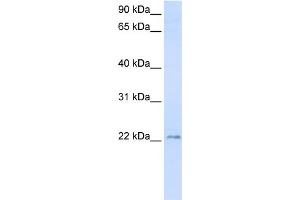 WB Suggested Anti-TMEM9 Antibody Titration:  0.