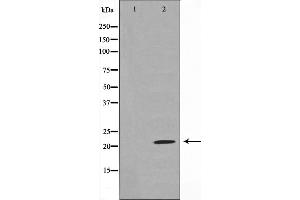 Western blot analysis on rat liver cell lysate using Claudin 7 Antibody,The lane on the left is treated with the antigen-specific peptide. (Claudin 7 抗体  (C-Term))