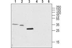 Transmembrane Protein 38A (TMEM38A) peptide