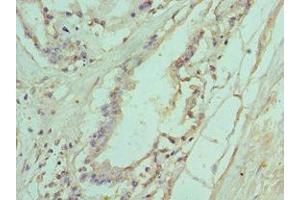 Immunohistochemistry of paraffin-embedded human prostate tissue using ABIN7156772 at dilution of 1:100 (IL11RA 抗体  (AA 30-290))