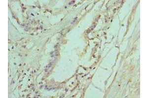 Immunohistochemistry of paraffin-embedded human prostate tissue using ABIN7156772 at dilution of 1:100