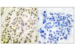 Immunohistochemistry (IHC) image for anti-Transglutaminase 4 (Prostate) (TGM4) (C-Term) antibody (ABIN5976383) (TGM4 抗体  (C-Term))
