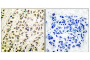 Immunohistochemistry (IHC) image for anti-Transglutaminase 4 (Prostate) (TGM4) (C-Term) antibody (ABIN1848512) (TGM4 抗体  (C-Term))