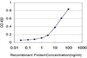 Detection limit for recombinant GST tagged ERN1 is approximately 1ng/ml as a capture antibody. (ERN1 抗体  (AA 401-500))