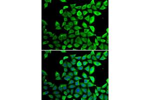 Immunofluorescence analysis of U20S cell using PPID antibody. (PPID 抗体)