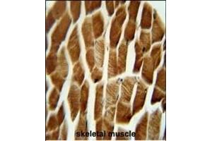 Immunohistochemistry (Paraffin-embedded Sections) (IHC (p)) image for anti-Adaptor-Related Protein Complex 1, sigma 3 Subunit (AP1S3) (AA 8-37), (N-Term) antibody (ABIN654348)