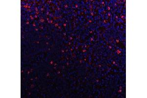 IF analysis of CD79b using anti-CD79b antibody (ABIN3043398). (CD79b 抗体  (AA 29-229))