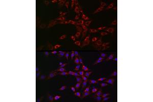 Immunofluorescence analysis of NIH/3T3 cells using CHMP6 Rabbit pAb (ABIN6133624, ABIN6138551 and ABIN7101747) at dilution of 1:100 (40x lens). (CHMP6 抗体)
