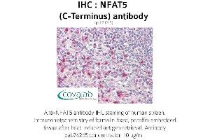 Image no. 1 for anti-Nuclear Factor of Activated T-Cells 5, Tonicity-Responsive (NFAT5) antibody (ABIN1737328) (NFAT5 抗体)