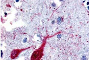 Immunohistochemistry (Paraffin-embedded Sections) (IHC (p)) image for anti-Solute Carrier Family 5 (Sodium/glucose Cotransporter), Member 9 (SLC5A9) (Cytoplasmic Domain) antibody (ABIN213409)