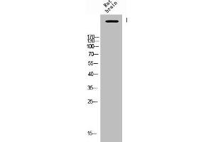 Western Blot analysis of Rat-brain cells using Phospho-IP3R-I (S1764) Polyclonal Antibody (ITPR1 抗体  (pSer1764))