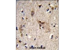Formalin-fixed and paraffin-embedded human brain tissue reacted with ALDH18A1 Antibody (Center), which was peroxidase-conjugated to the secondary antibody, followed by DAB staining. (P5CS 抗体  (AA 176-205))