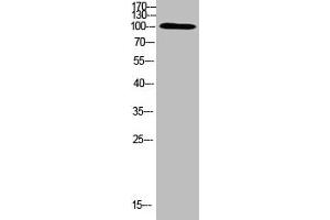 Western Blot analysis of HEPG2 cells using Antibody diluted at 500 (TRPV4 抗体  (AA 461-510))