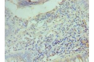 Immunohistochemistry (IHC) image for anti-Cyclin D2 (CCND2) (AA 1-289) antibody (ABIN7153389)