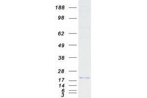 Western Blotting (WB) image for Retinoic Acid Receptor Responder (Tazarotene Induced) 2 (RARRES2) protein (Myc-DYKDDDDK Tag) (ABIN2730512)