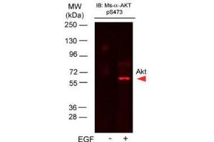 Western Blotting (WB) image for anti-V-Akt Murine Thymoma Viral Oncogene Homolog 1 (AKT1) (pSer473) antibody (ABIN964561)
