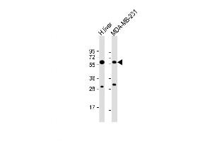 Western Blot at 1:8000 dilution Lane 1: human liver lysate Lane 2: MDA-MB-231 whole cell lysate Lysates/proteins at 20 ug per lane. (UGT2B4 抗体  (N-Term))