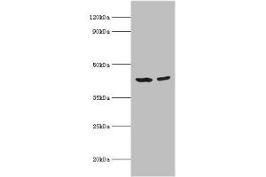 Western blot All lanes: Short-chain specific acyl-CoA dehydrogenase, mitochondrial antibody at 7 μg/mL Lane 1: 293T whole cell lysate Lane 2: HepG2 whole cell lysate Secondary Goat polyclonal to rabbit IgG at 1/10000 dilution Predicted band size: 44 kDa Observed band size: 44 kDa (ACADS 抗体  (AA 1-260))