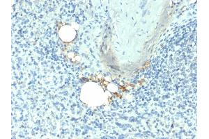 Formalin-fixed, paraffin-embedded human Spleen stained with TRAcP Mouse Monoclonal Antibody (ACP5/1070). (ACP5 抗体)