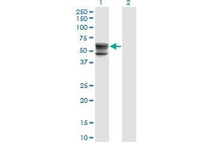 Western Blot analysis of CHST12 expression in transfected 293T cell line by CHST12 monoclonal antibody (M01), clone 3D6. (CHST12 抗体  (AA 56-150))