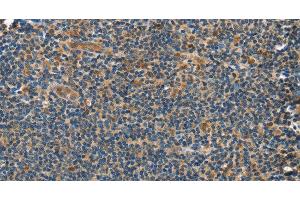 Immunohistochemistry of paraffin-embedded Human tonsil tissue using GRB7 Polyclonal Antibody at dilution 1:40 (GRB7 抗体)