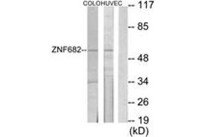 Western blot analysis of extracts from COLO205/HuvEc cells, using ZNF682 Antibody. (ZNF682 抗体  (AA 21-70))