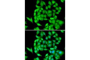 Immunofluorescence analysis of HeLa cells using NEK3 antibody. (NEK3 抗体  (AA 267-506))