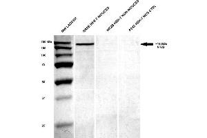Western Blotting (WB) image for anti-Glutamate Receptor, Ionotropic, N-Methyl D-Aspartate 2B (GRIN2B) (AA 20-271) antibody (PerCP) (ABIN2483220)