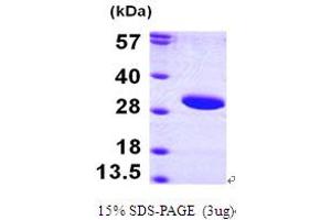 SDS-PAGE (SDS) image for Sirtuin 3 (SIRT3) (AA 118-399) protein (His tag) (ABIN667166) (SIRT3 Protein (AA 118-399) (His tag))