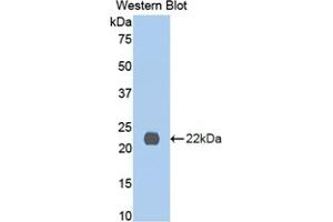 Western blot analysis of the recombinant protein. (IL13 Receptor alpha 1 抗体  (AA 201-360))
