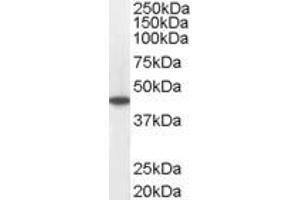 ABIN184850 staining (0. (Medium-Chain Specific Acyl-CoA Dehydrogenase, Mitochondrial (C-Term) 抗体)
