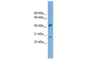 Western Blot showing SLC25A37 antibody used at a concentration of 1-2 ug/ml to detect its target protein. (SLC25A37 抗体  (Middle Region))